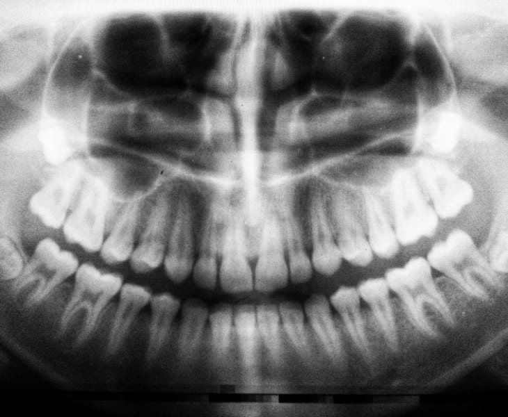 Najlepsze praktyki w zakresie przeciwdziałania infekcjom krzyżowym w klinice stomatologicznej